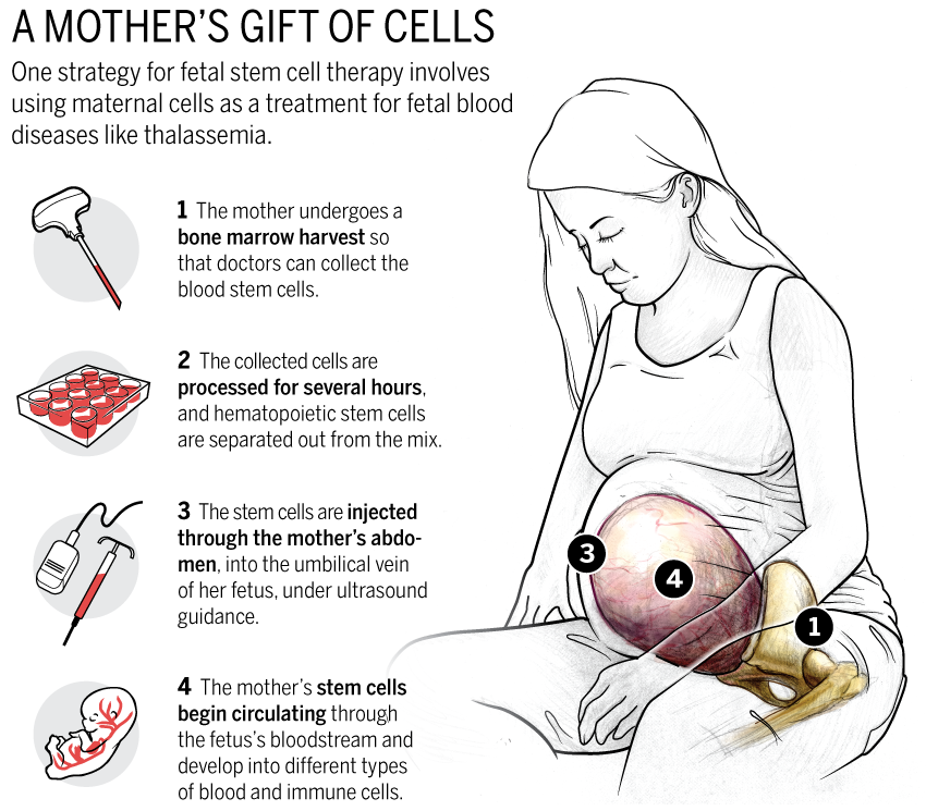 Fetal Cells