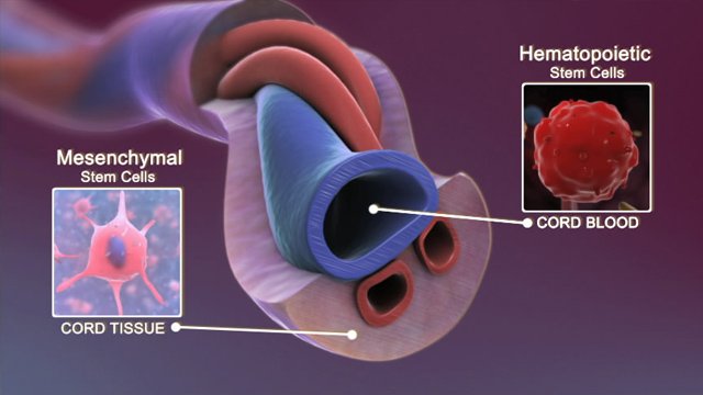 Umbilical cord blood stem cells
