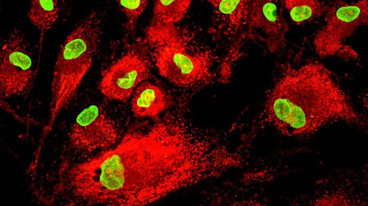 Mesenchymal Stem Cells