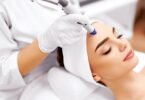 Microneedling: Benefits, Risk & More!