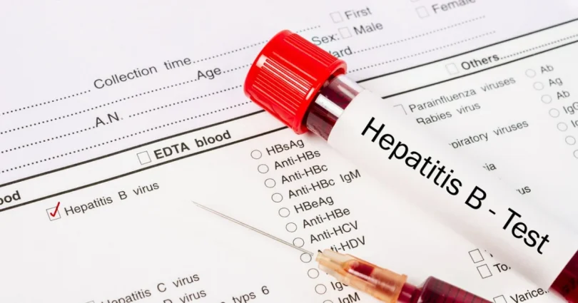 Hepatitis B Surface Antigen (HBsAg Blood Test)