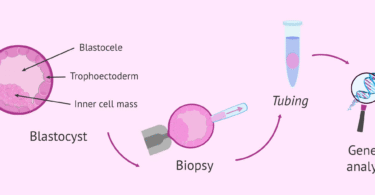 The Different Types of Embryo Biopsy Techniques