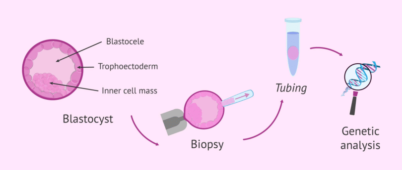 The Different Types of Embryo Biopsy Techniques