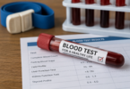 Understanding Blood Tests: Types, Results & What They Mean